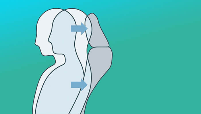 Whiplash Injury Lessening Seat